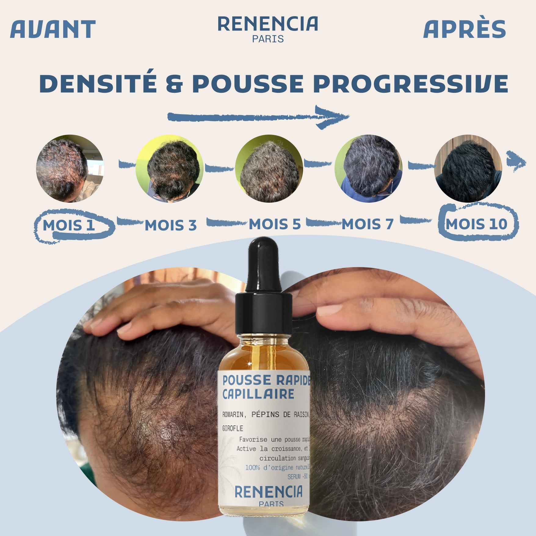 Huile cheveux croissance - 50ml